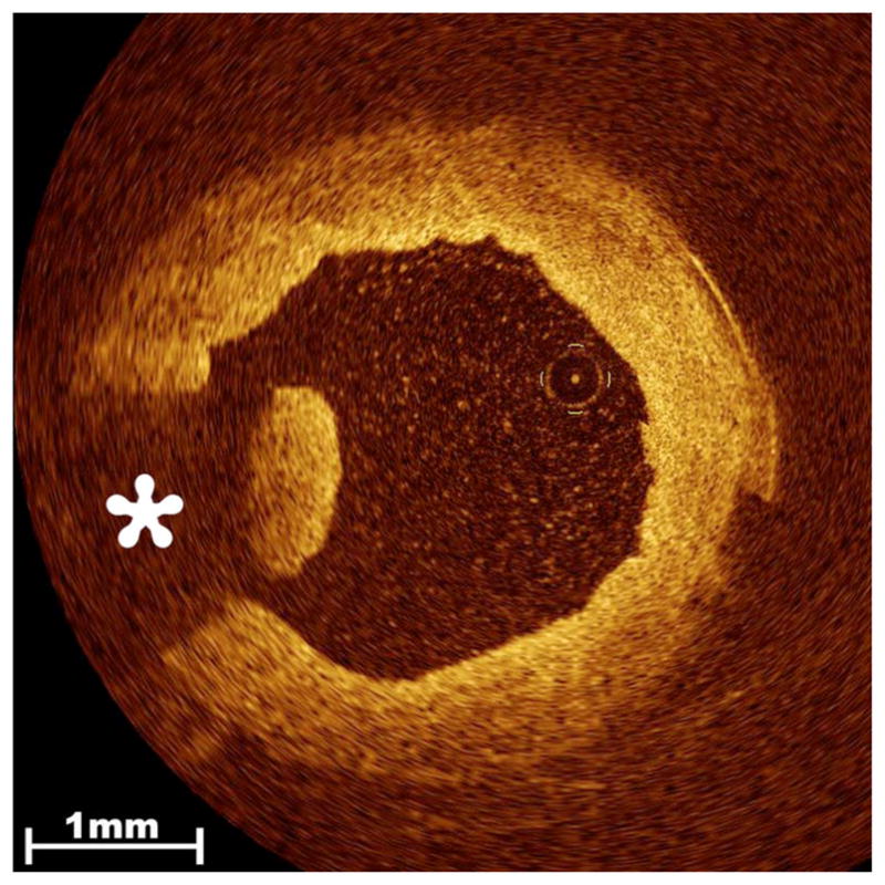 Fig. 5