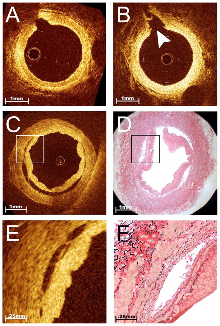 Fig. 4