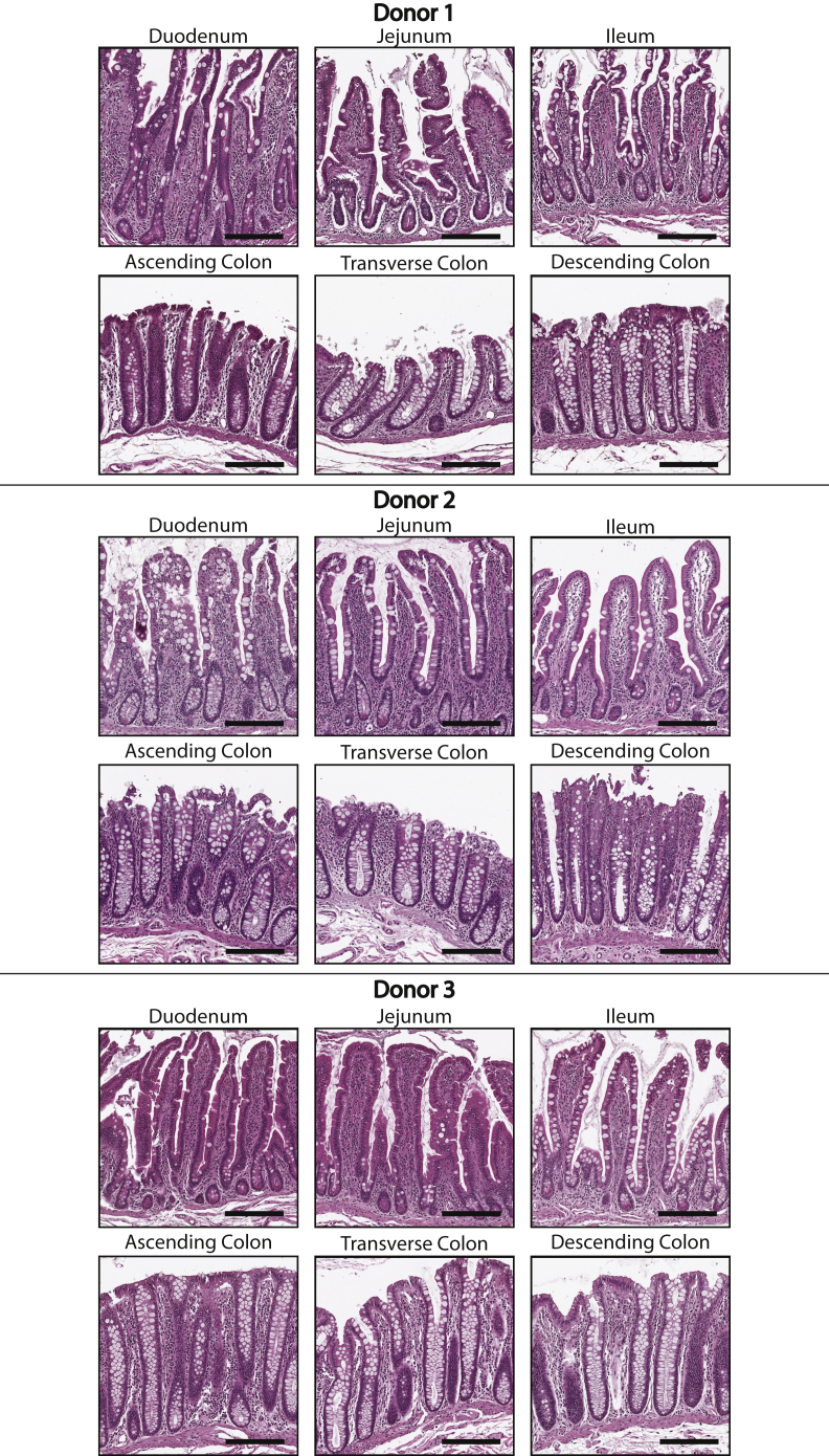 Figure 17