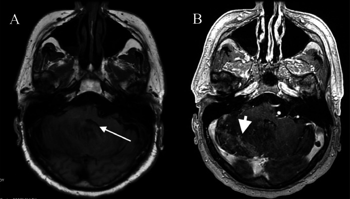 Fig 4: