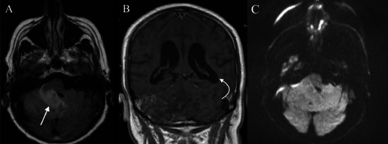 Fig 1: