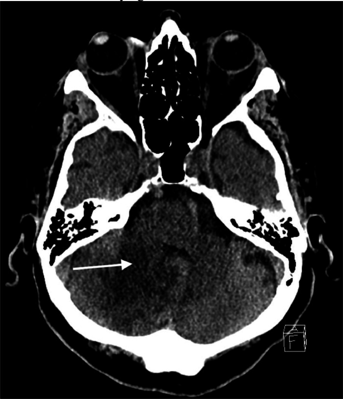 Fig 3: