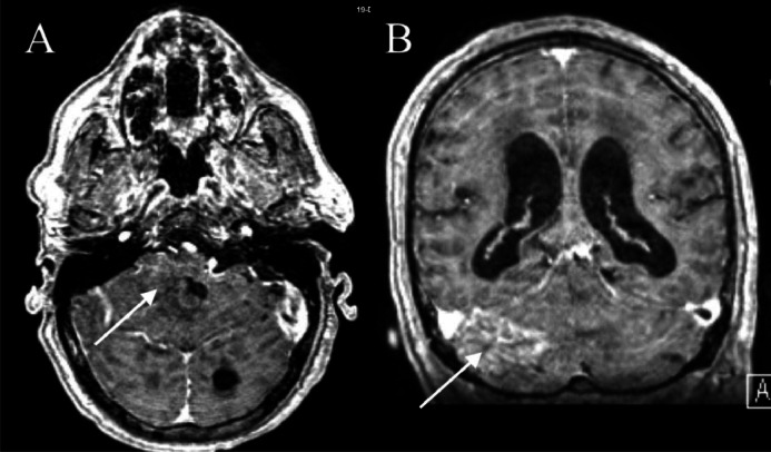 Fig 2: