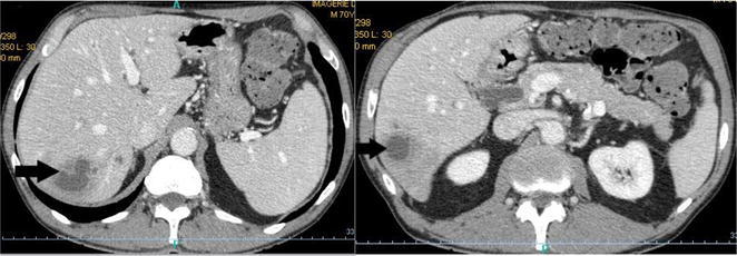 Fig. 1