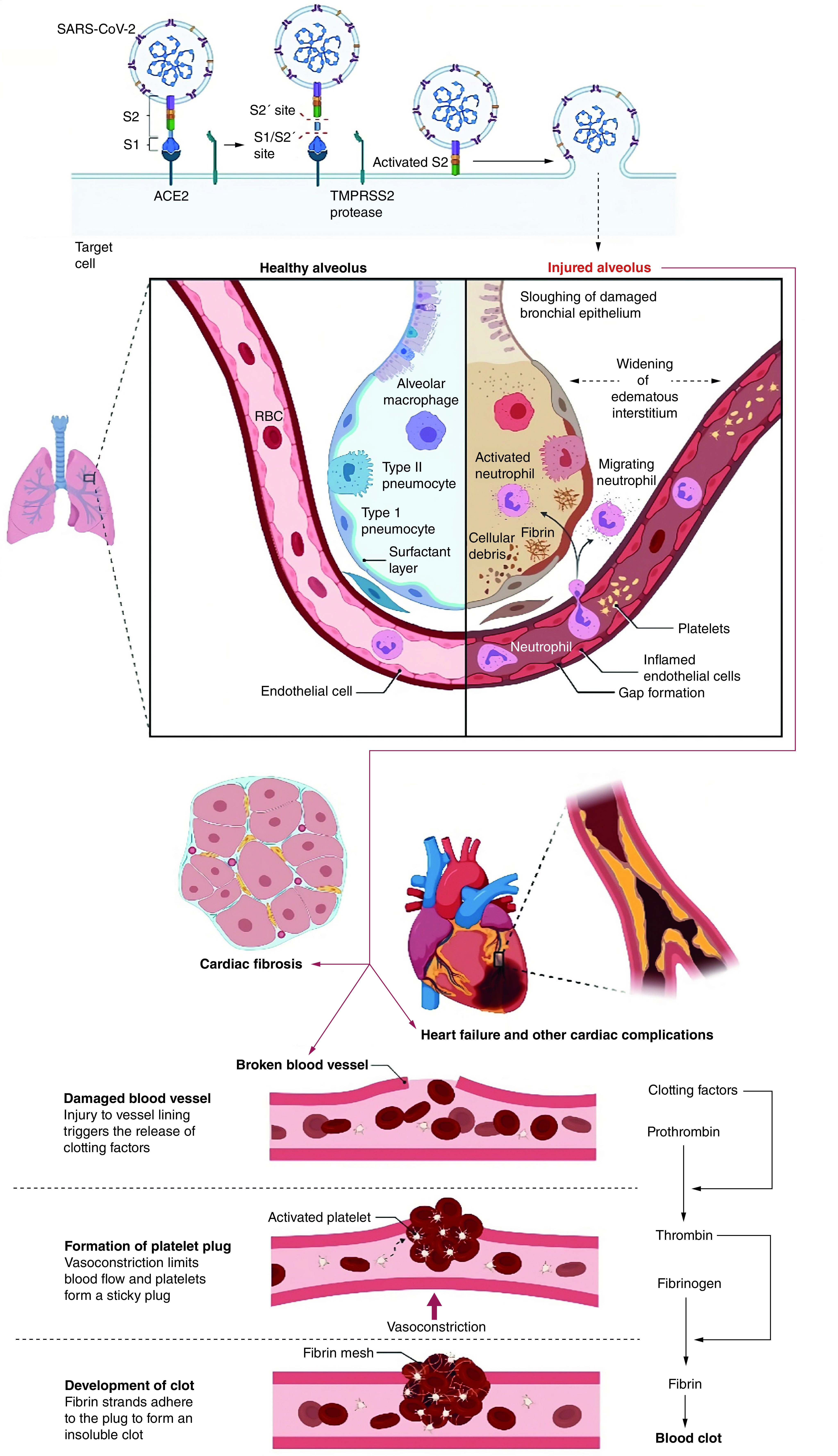 Figure 2. 