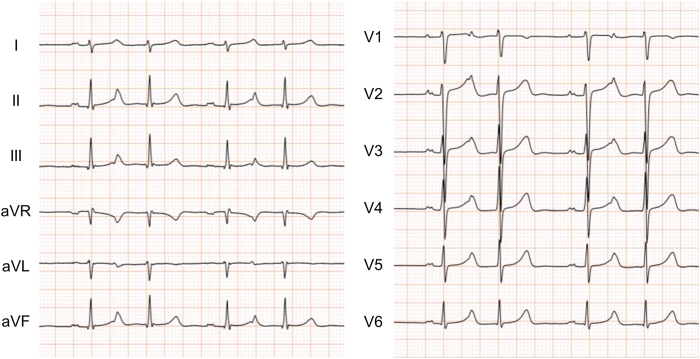 Figure 1