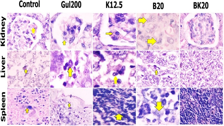 Figure 18