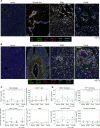 Figure 2. PanIN lesions in healthy pancreata are surrounded by a unique microenvironment. A, mfIHC composite images of FFPE donor tissue specimens, highlighting acinar, normal duct, ADM, and PanIN structures. Antibodies and colors of the immune panel used are in the legend below. PanCK, pancytokeratin. B, mfIHC composite images of FFPE donor tissue specimens, highlighting acinar, normal duct, ADM, and PanIN structures. Antibodies and colors of the fibroblast panel used are in the legend below. C, Quantification of percent positive CD163+ cells (top left), CD8+ T cells (top right), CD4+ T cells (bottom left), and Tregs (bottom right) surrounding acinar, ADM, duct, and PanIN populations, respectively. Asterisks denote a P value of <0.05, as determined by ANOVA. HPF, high-power field. D, Quantification of percent positive SMA+ cells (top left), vimentin+ cells (bottom left), FAP+ cells (top right), and PDGFR+ cells (bottom right) surrounding acinar, ADM, duct, and PanIN populations, respectively. Asterisks denote a P value of <0.05, as determined by ANOVA.