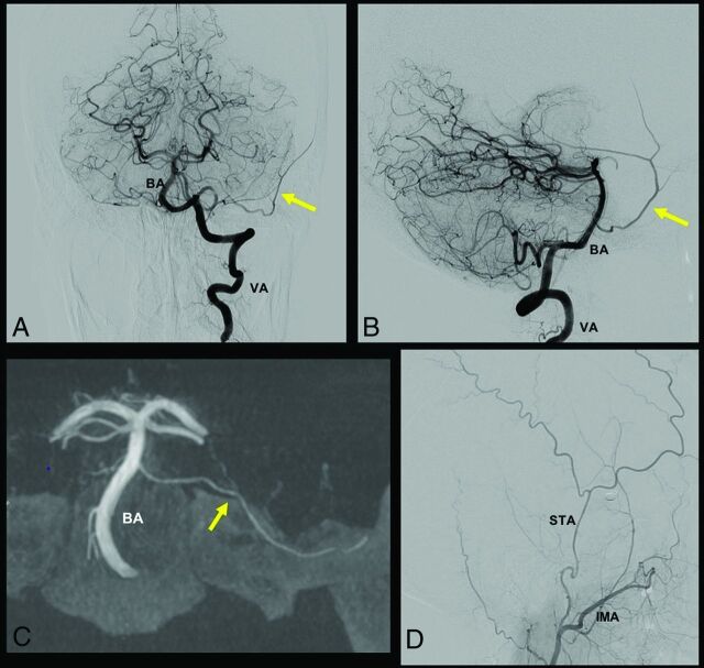 FIG 1.