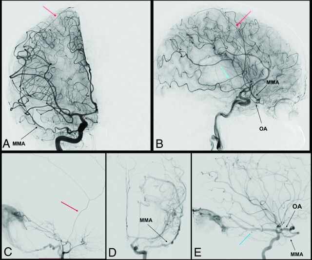 FIG 2.