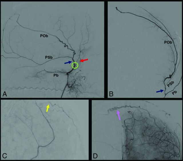 FIG 3.