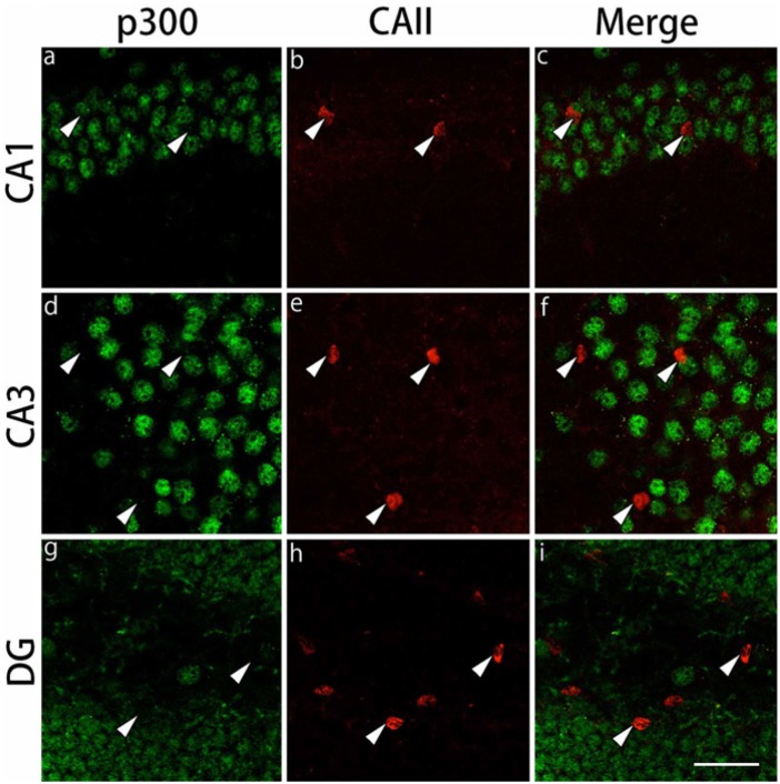 Figure 11.