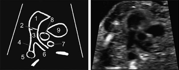 Figure 21