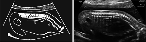 Figure 37