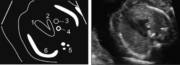 Figure 23