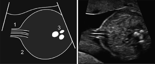 Figure 32