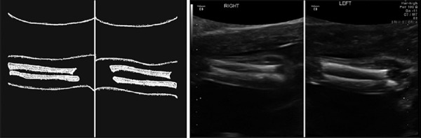 Figure 46