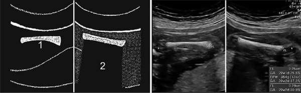 Figure 41