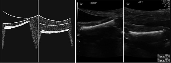 Figure 45