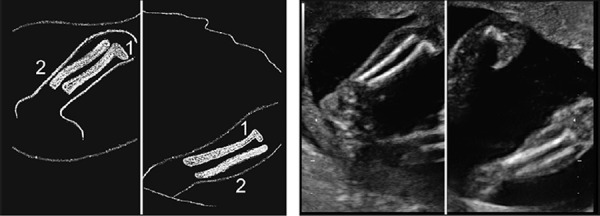 Figure 42