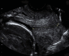Figure 53