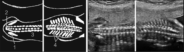 Figure 38