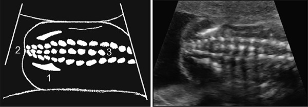 Figure 39