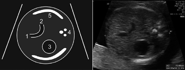 Figure 31