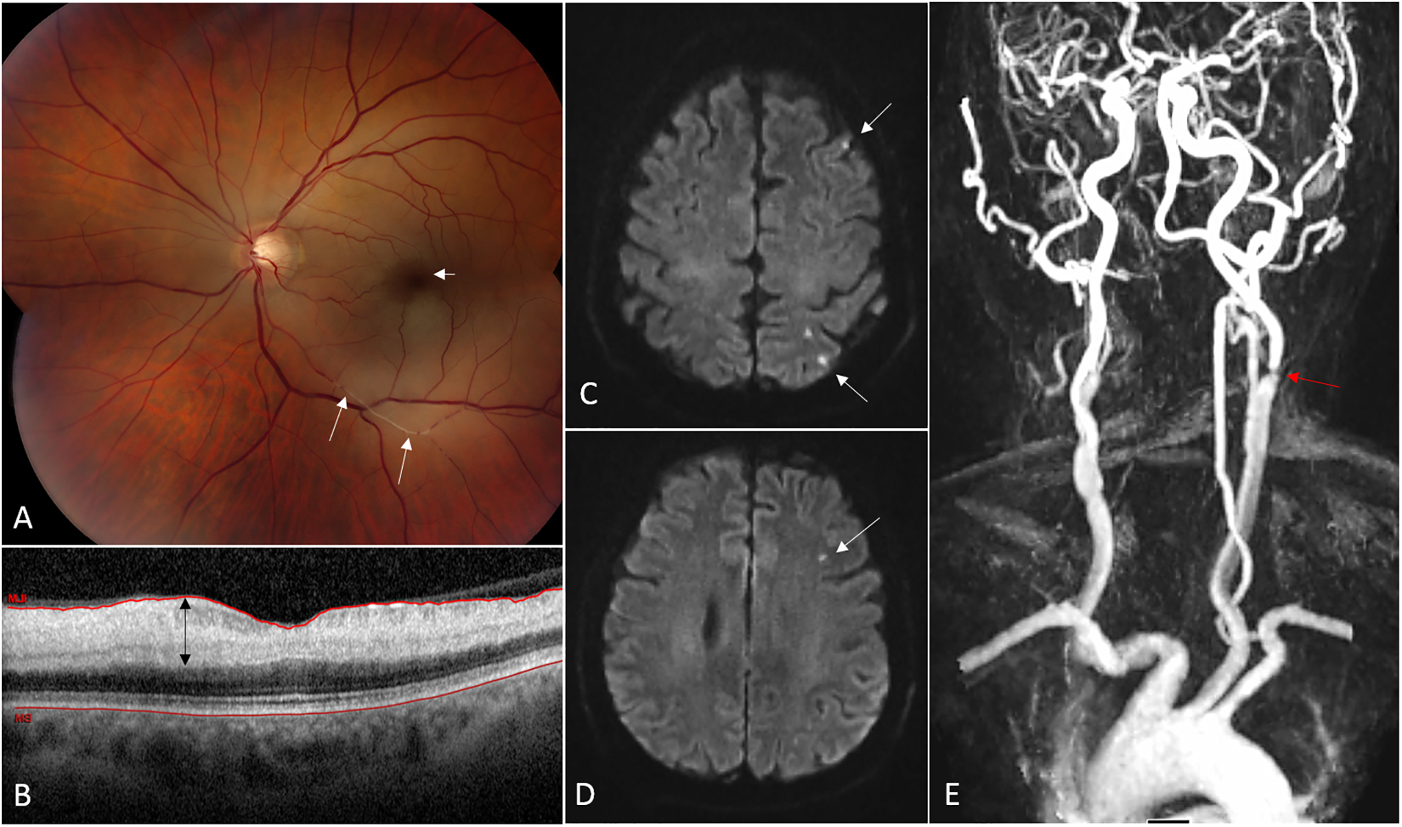 Figure 2: