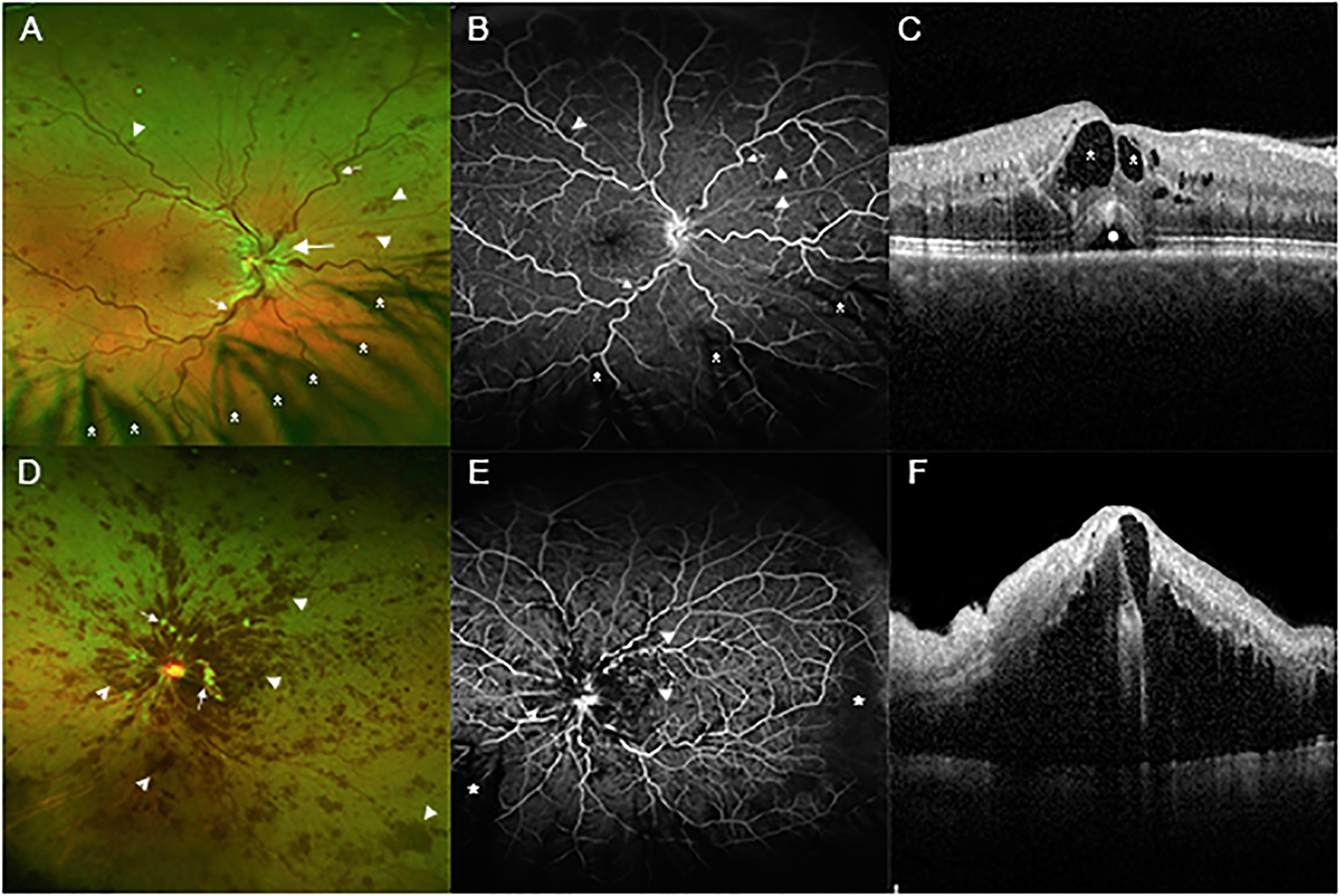 Figure 3: