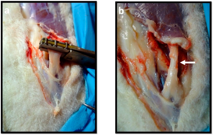 Figure 14