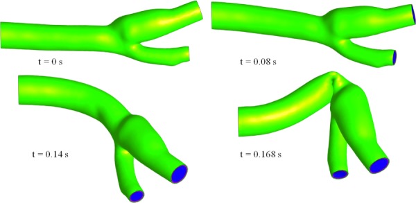 Fig. 15