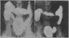 882