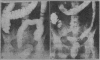 882