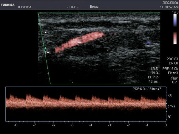 Figure 11