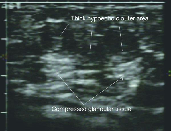 Figure 19