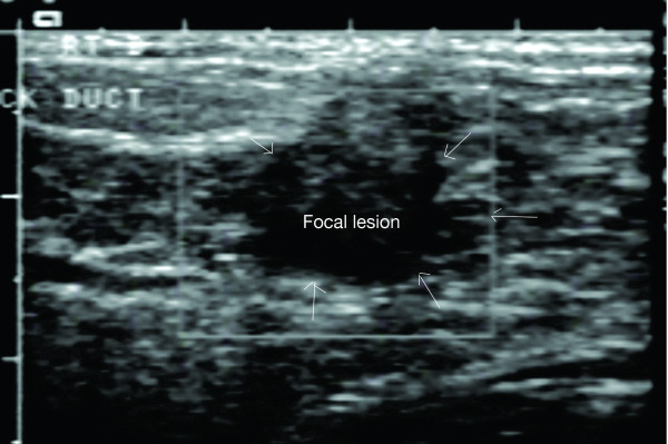 Figure 18