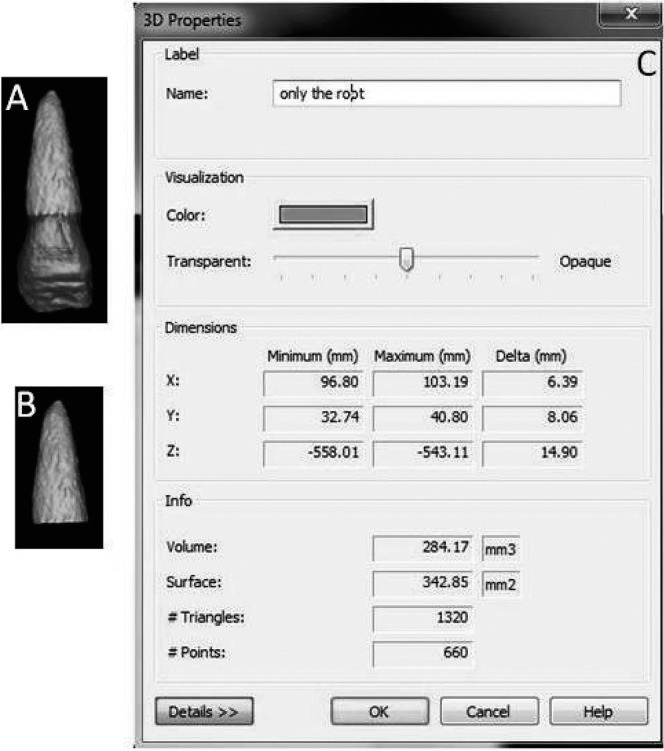 Figure 5. Volumetric measurements: (A) Reconstruction of whole tooth. (B) Separation of root from the crown. (C) Volume calculated.