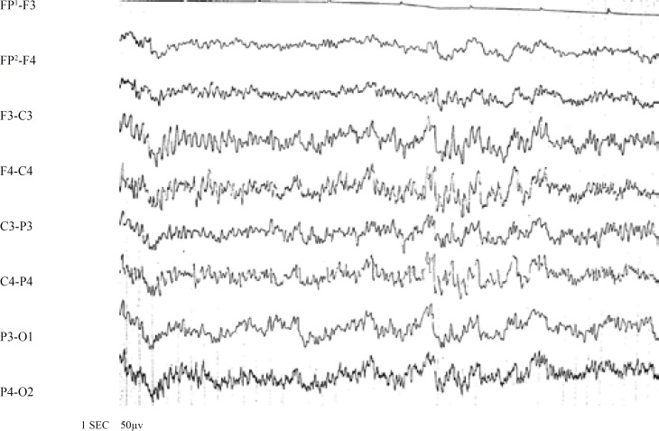 Fig 2