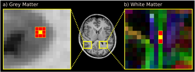 Fig. 1