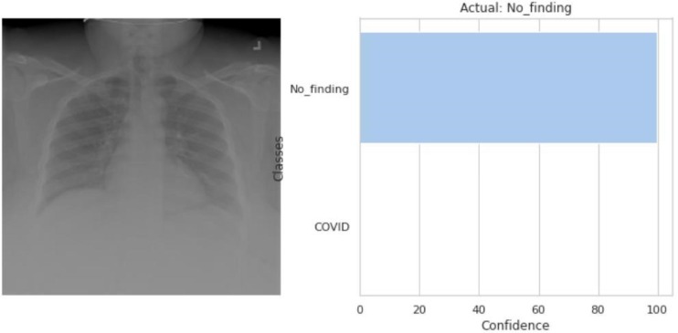 Fig. 3.11