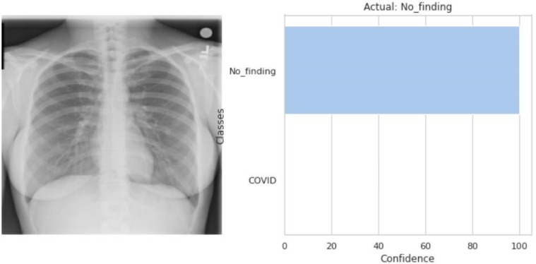 Fig. 3.15