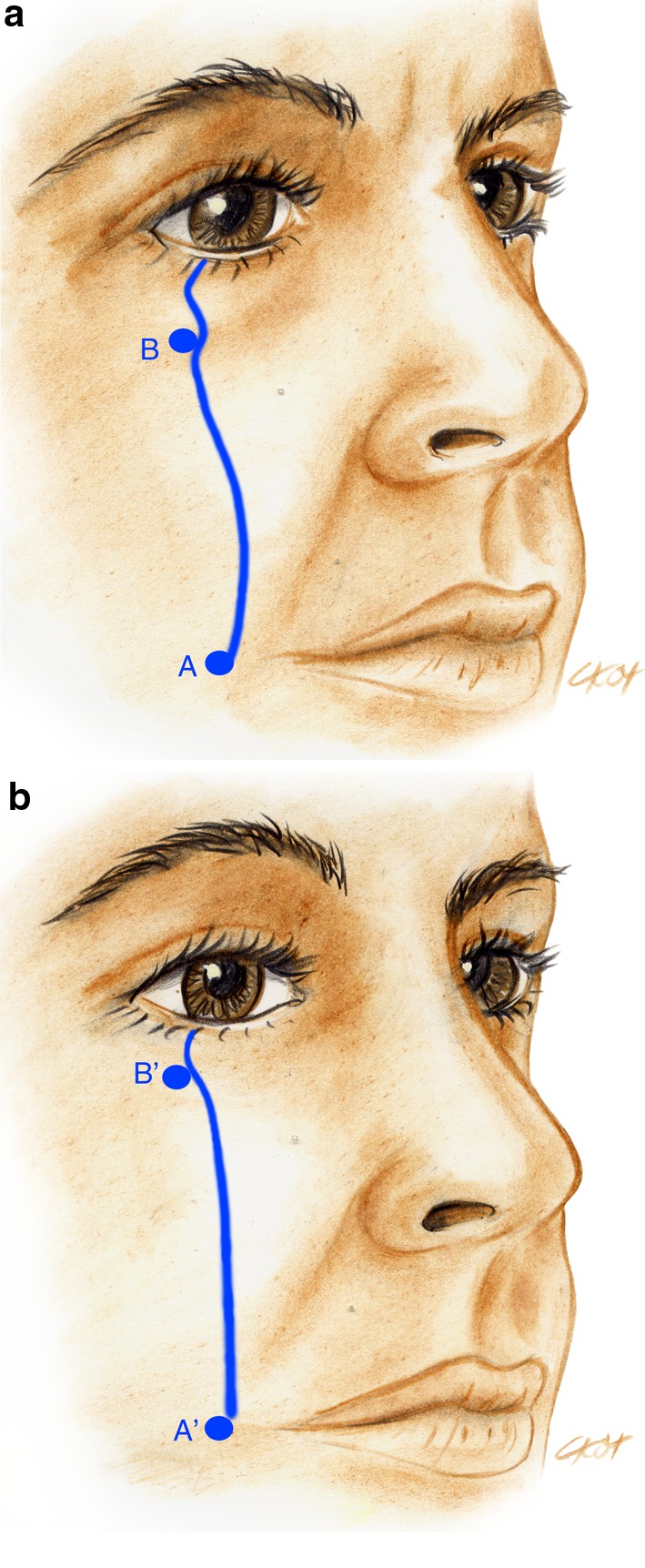 Fig. 12