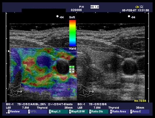 Fig. 6