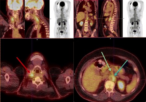 Fig. 3