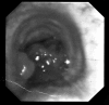 Fig. 1a