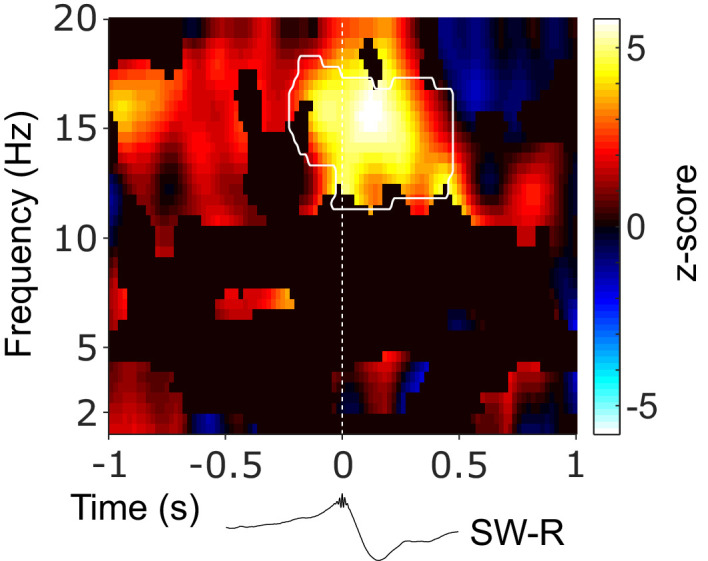 Figure 3—figure supplement 3.