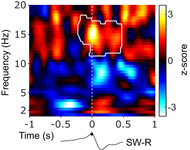 Figure 3—figure supplement 1.