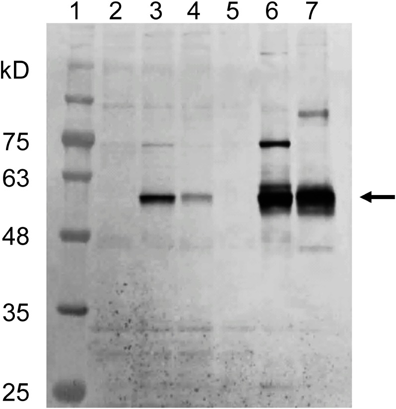 Fig. 2. Expression of A. gossypii CYP6CY22 and CYP6CY13 genes in transfected D. melanogaster S2 cells. Lane 1=molecular weight standards. Lanes 2 and 5=negative control, cells transfected only with the pAc5.1 vector without inserted genes. Lanes 3 and 4=cells transfected with c21228_g1 and c21368_g1 genes and cultured in normal medium (Schneider’s Drosophila Medium with 10% FBS). Lanes 6 and 7=cells transfected with c21228_g1 and c21368_g1 genes (59 kDa) and cultured in CYP expression medium (Insectagro DS2 medium supplemented with 0.1 mM ferric citrate, 0.1 mM 5-aminolevulinic acid, and 4 mM Ala-Glu without FBS).