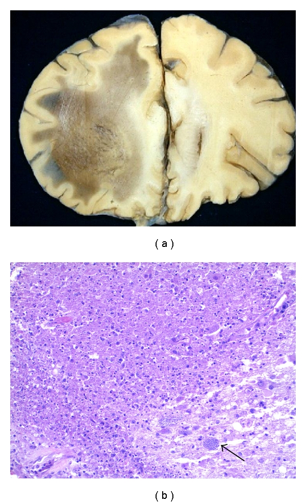 Figure 13